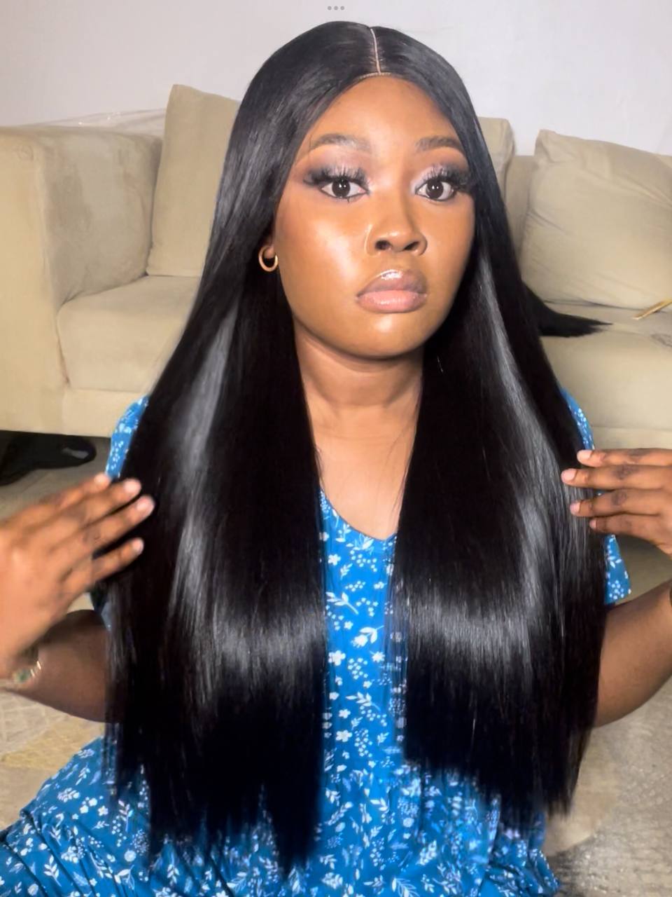 TYS8: SDD RAW VIETNAM DONOR INVESTMENT BONE STRAIGHT